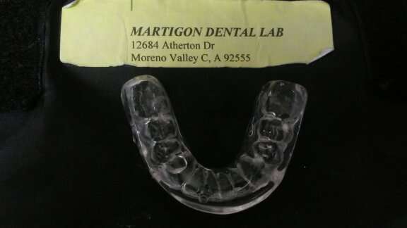 Martigon Dental Lab | 12684 Atherton Dr, Moreno Valley, CA 92555, USA | Phone: (951) 247-3459