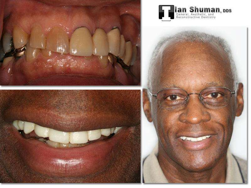 Dr. Ian Shuman, DDS | 8028 Ritchie Hwy Suite 306, Pasadena, MD 21122, USA | Phone: (410) 766-5104