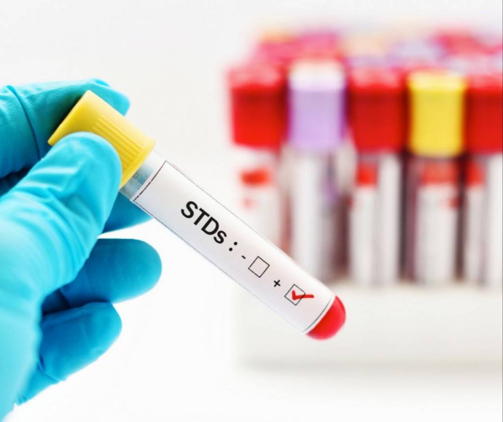 Labtek STD Testing Centers | 1615 Hospital Pkwy, Bedford, TX 76022, USA | Phone: (817) 663-8235