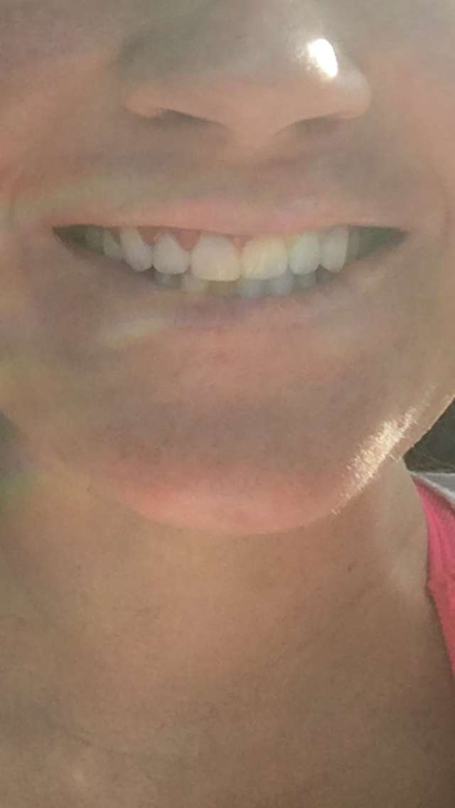 Sunshine Dental: Chau Hung DDS | 3444 Ella Blvd A, Houston, TX 77018, USA | Phone: (713) 701-9305