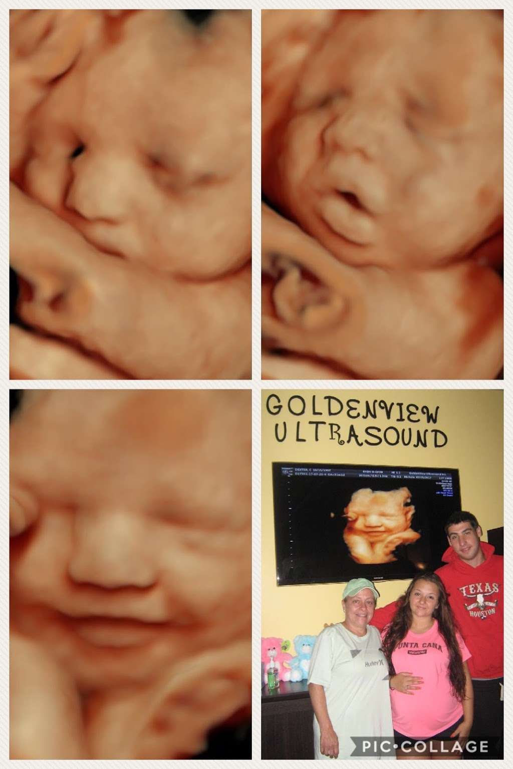 Goldenview Ultrasound 3d/4d/HD San Antonio | 11825 Interstate 10 west suite 201, San Antonio, TX 78230, USA | Phone: (888) 915-2229