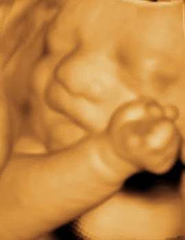 Ultrasound Baby Images | 12500 Riverside Dr #204, Valley Village, CA 91607 | Phone: (818) 761-4300