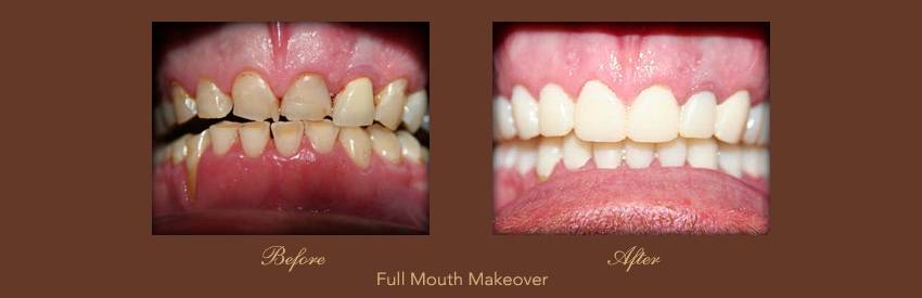 Impressions Dental | 5970 S Cooper Rd Ste 1, Chandler, AZ 85249, USA | Phone: (480) 814-8888