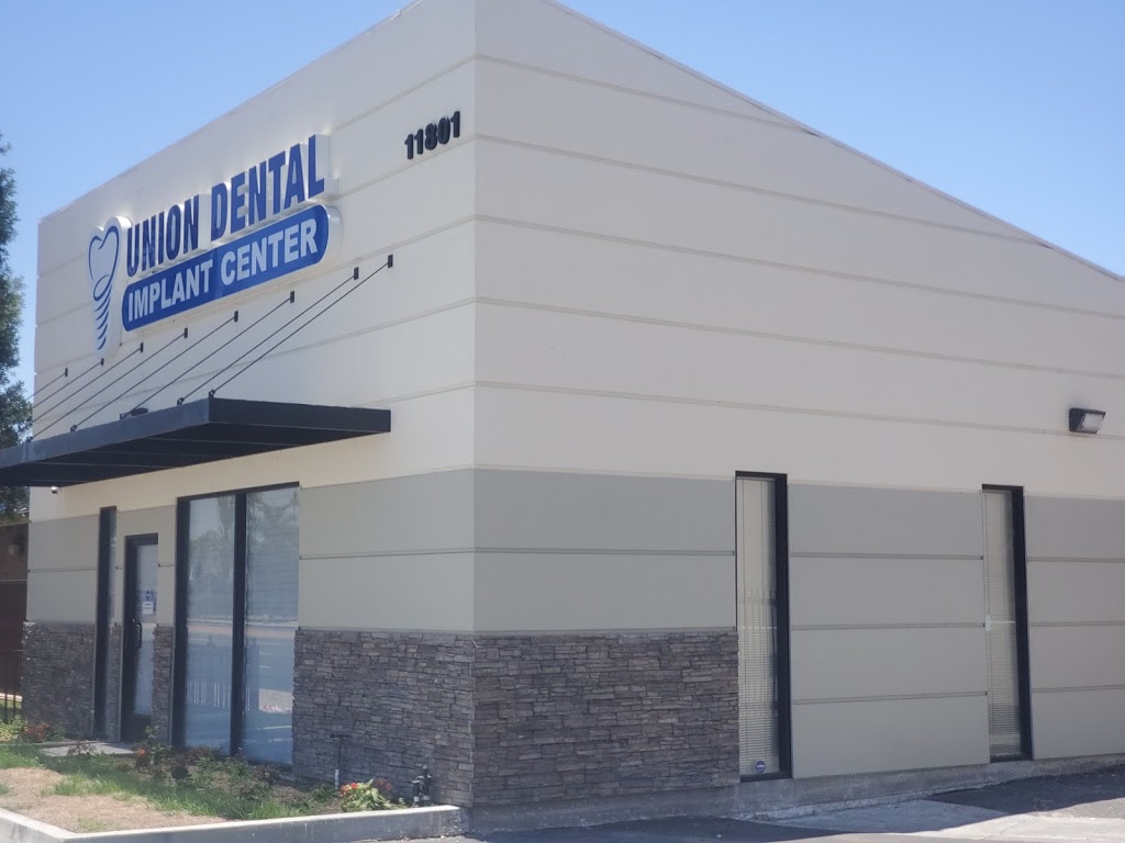 Union Dental Group | 11801 Beach Blvd, Stanton, CA 90680, USA | Phone: (714) 902-1150
