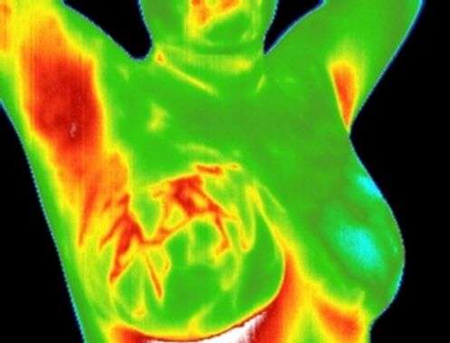 Thermography of Crosby | 118 Kernohan St, Crosby, TX 77532, USA | Phone: (281) 886-8801