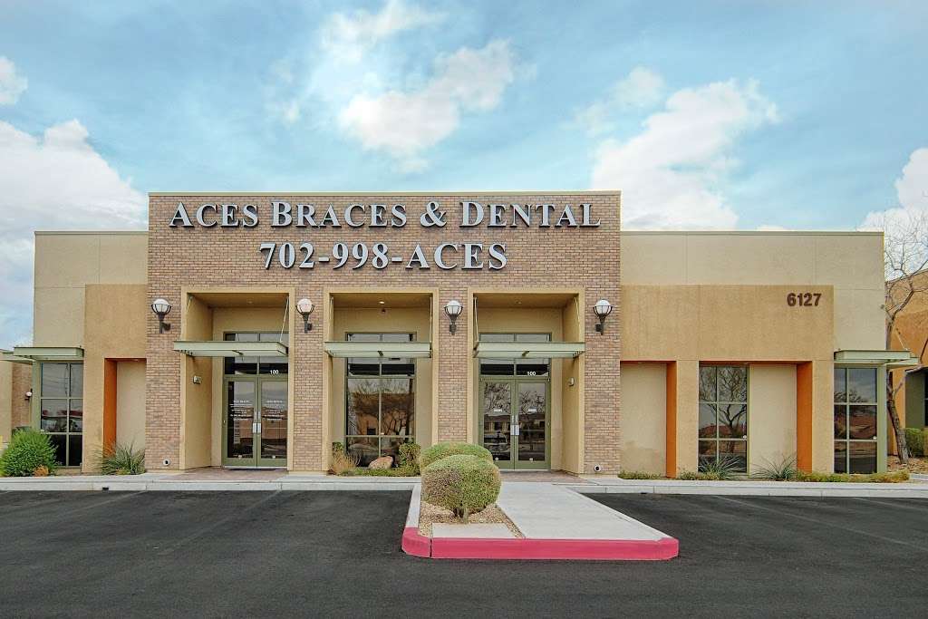 Aces Dental | 6127 S Rainbow Blvd #100A, Las Vegas, NV 89118, USA | Phone: (702) 998-2237