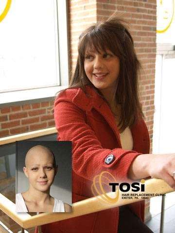 Tosis Hair Replacement Clinic | 390 Slocum Ave, Exeter, PA 18643, USA | Phone: (570) 693-3276