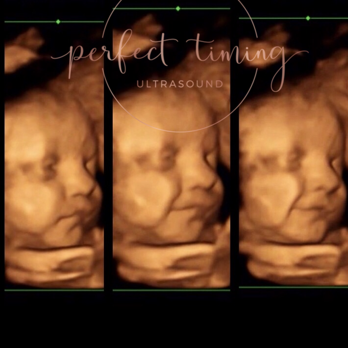 Perfect Timing Ultrasound | 6 Resnik Rd #202, Plymouth, MA 02360, USA | Phone: (508) 591-7956