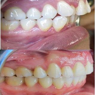 Nevada Dentistry & Braces | 4492 S Pecos Rd, Las Vegas, NV 89121, USA | Phone: (702) 701-7999