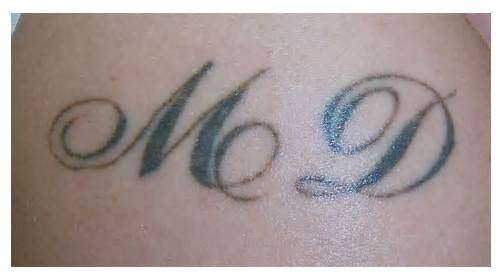 Disappearing Ink | 2301 Harrisburg Pike Suite 203, Lancaster, PA 17601, USA | Phone: (717) 572-2009