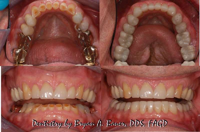 Bauer Dentistry and Orthodontics | 623 S Naperville Rd, Wheaton, IL 60187, USA | Phone: (630) 665-5550
