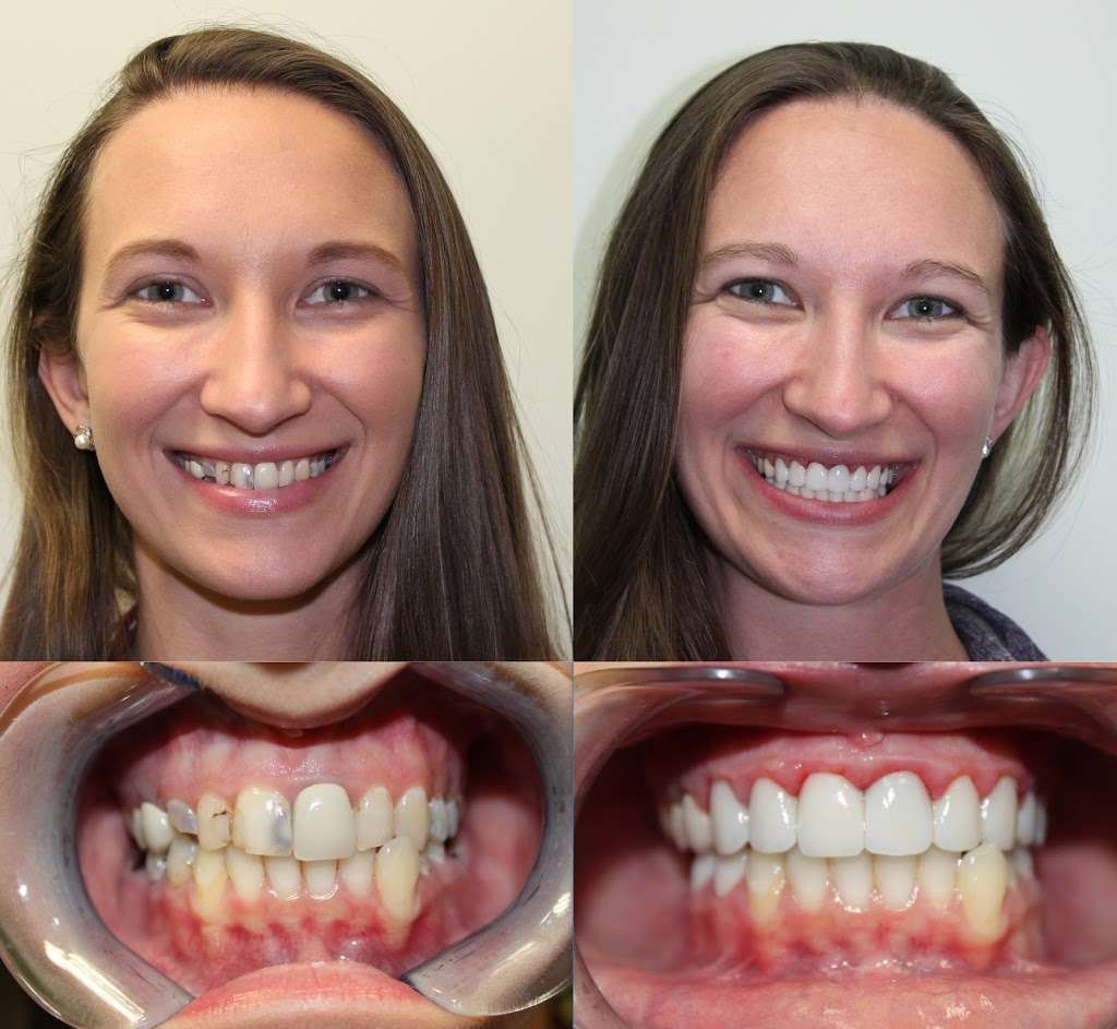 Dental Garden | 8710 Grand Mission Blvd A, Richmond, TX 77407, USA | Phone: (281) 853-9215