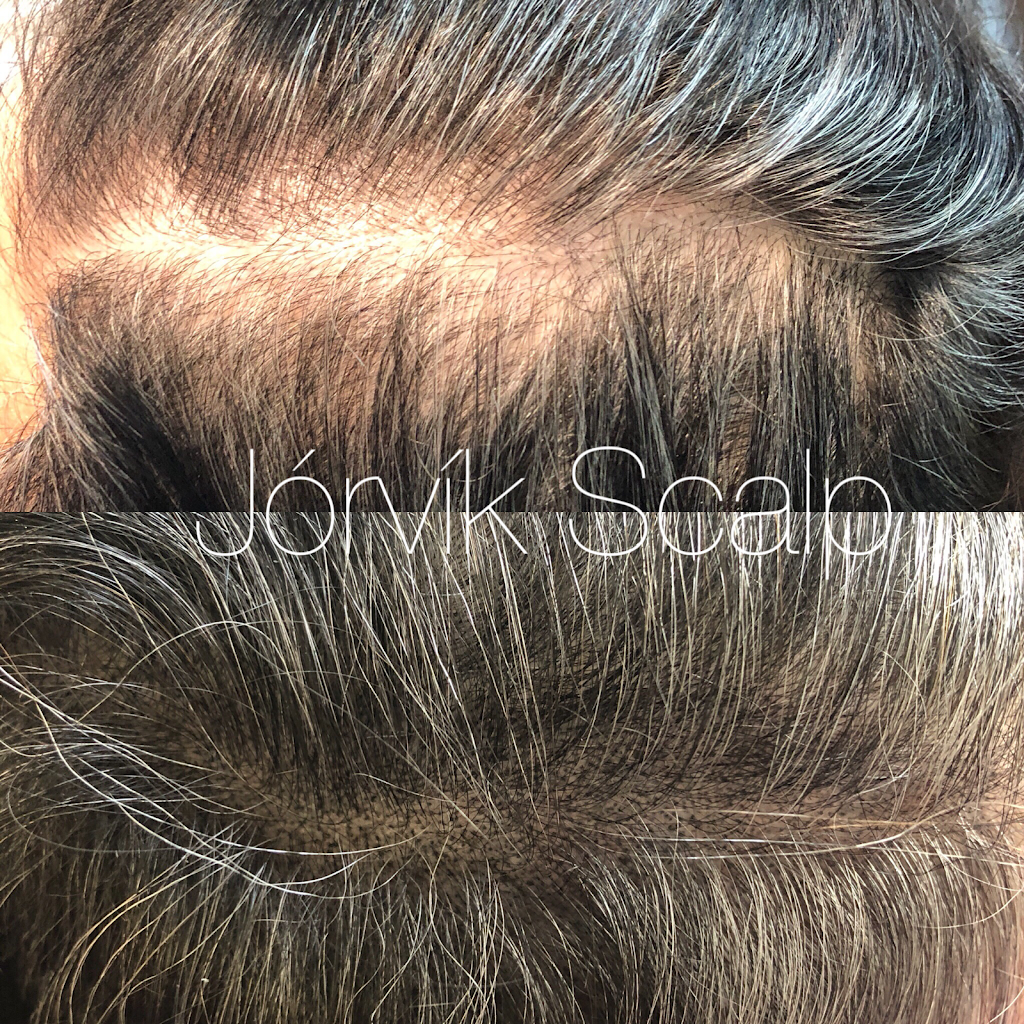 Jorvik Aesthetics - Houston Scalp Micropigmentation (SMP) | 4101 Greenbriar Dr #240, Houston, TX 77098, USA | Phone: (832) 793-9151