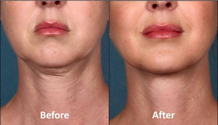 Stallworth Facial Plastic Surgery | 21 Spurs Ln #120a, San Antonio, TX 78240, USA | Phone: (210) 997-3223