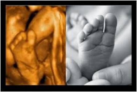 Fetal Memories 2D 3D 4D Ultrasound | 1018 N Tustin St, Orange, CA 92867, USA | Phone: (714) 769-2229