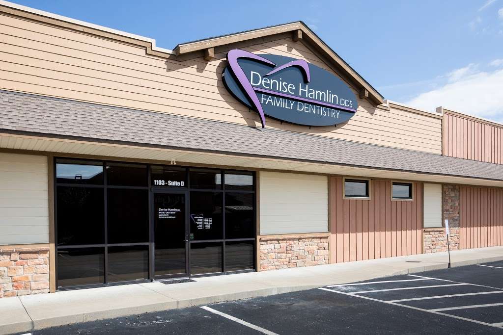 Denise Hamlin DDS | 1103 N Holden St #D, Warrensburg, MO 64093, USA | Phone: (660) 747-3171