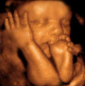 Baby to be Boutique LLC 3D/4D Ultrasounds | 15325 Lowry Dr, Greencastle, PA 17225, USA | Phone: (301) 992-4371