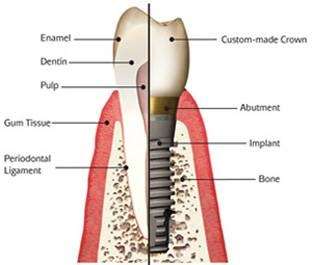 Frank Laaly DDS | 528 Amalia Ave, East Los Angeles, CA 90022, USA | Phone: (855) 524-6752