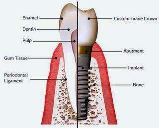 Pristine Dental | 2170 Main St suite h, Oakley, CA 94561, USA | Phone: (925) 679-3333