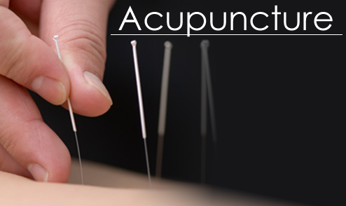 Points of Light Acupuncture | 11712 W North Ave c, Wauwatosa, WI 53226, USA | Phone: (414) 248-8000