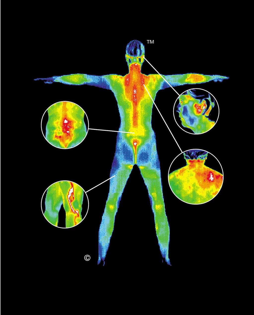 Thermography Of The Valley | 5011 N Granite Reef Rd, Scottsdale, AZ 85250, USA | Phone: (602) 505-7011