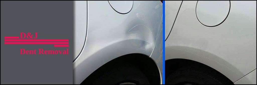 D&J Dent Removal | 2202 Cornell Ave, Montgomery, IL 60538, USA | Phone: (815) 212-0338