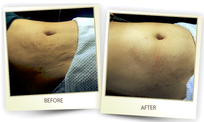 Texas Institute of Dermatology, Laser and Cosmetic Surgery | 24165 I-10, San Antonio, TX 78257, USA | Phone: (210) 698-6777