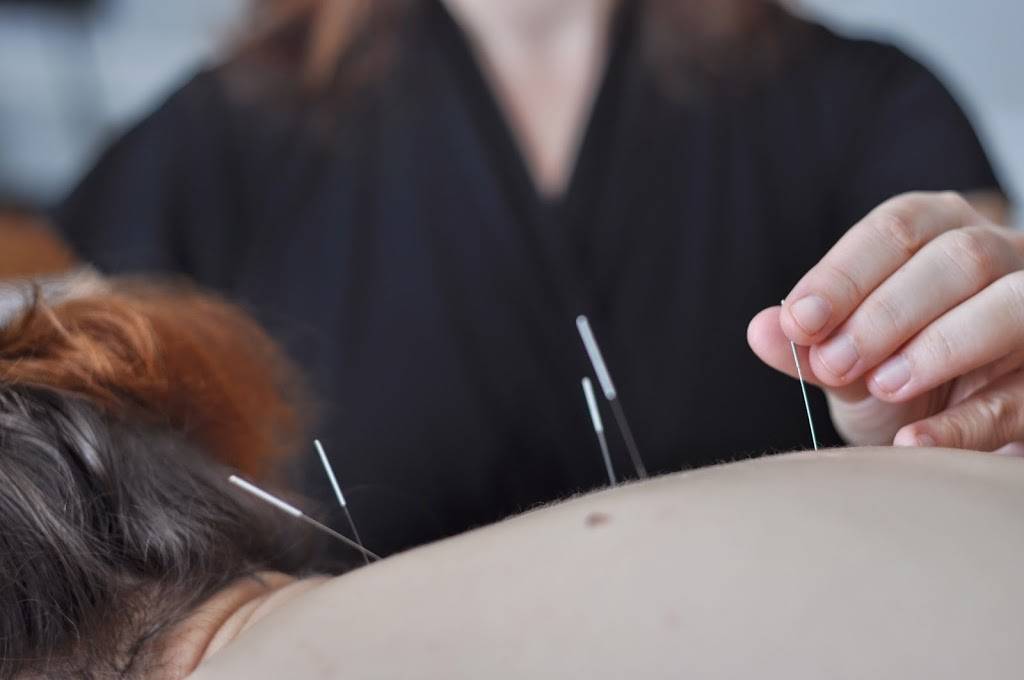 Altamonte Acupuncture | 650 Maitland Ave, Altamonte Springs, FL 32701 | Phone: (407) 260-8141