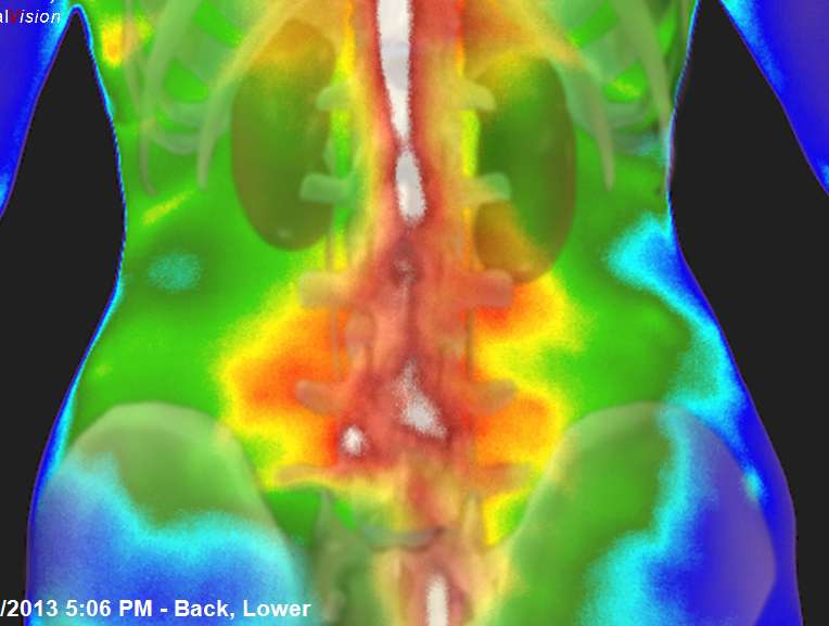 Lisas Thermography and Wellness Somers Point, NJ | 415 New Rd, Somers Point, NJ 08244 | Phone: (855) 667-9338