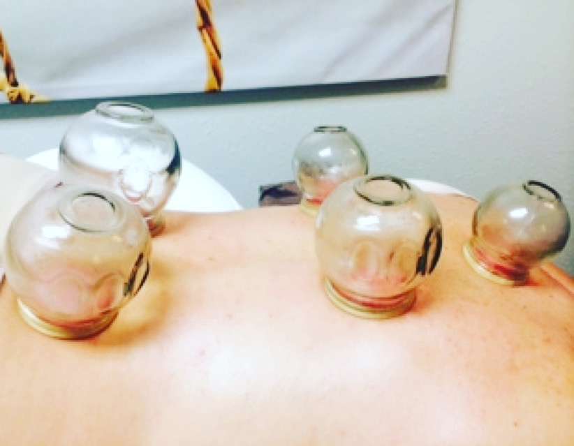 Holistic Healing Acupuncture | 1219 S Shepherd Dr, Houston, TX 77019 | Phone: (832) 647-5358