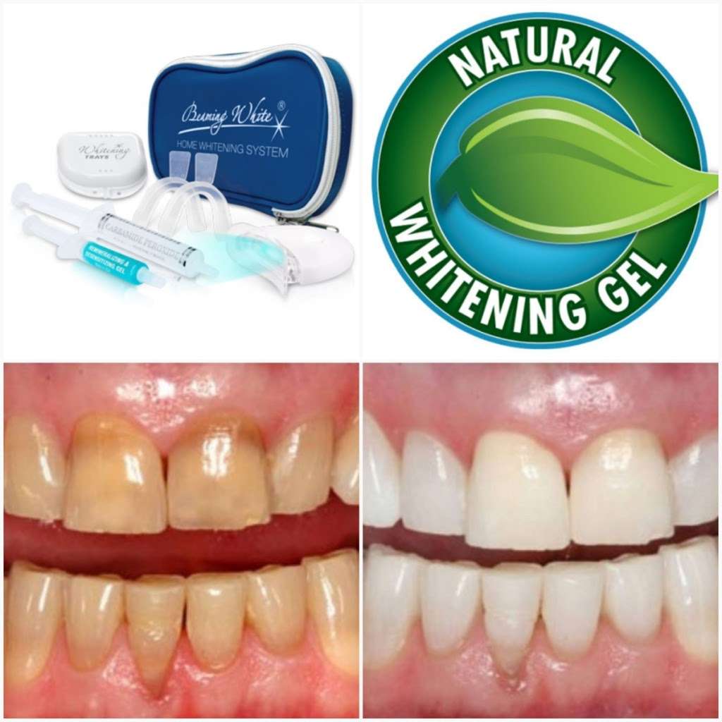 Luxury Bright White Smile | Los Angeles, CA 90027, USA | Phone: (213) 377-2700