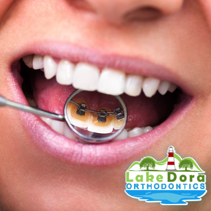 Escott Orthodontics - Lake County | 1200 Morningside Dr, Mt Dora, FL 32757, USA | Phone: (352) 383-6166