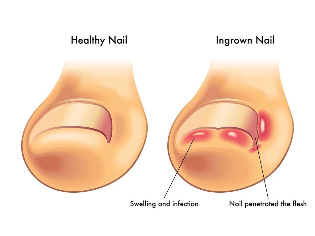 Corona Foot and Ankle Group - Dr. Arti C. Amin | 2083 Compton Ave Suite 103, Corona, CA 92881, USA | Phone: (951) 444-5327