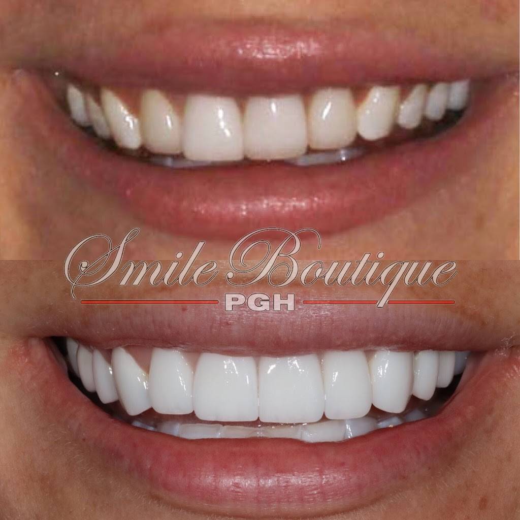 PGH Smile Boutique | 904 Warrendale Village Dr, Warrendale, PA 15086, USA | Phone: (724) 799-8100