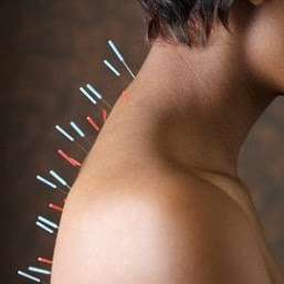 Whole Health Acupuncture | 50 Turner Ave Suite 101, Elk Grove Village, IL 60007, USA | Phone: (847) 357-3929