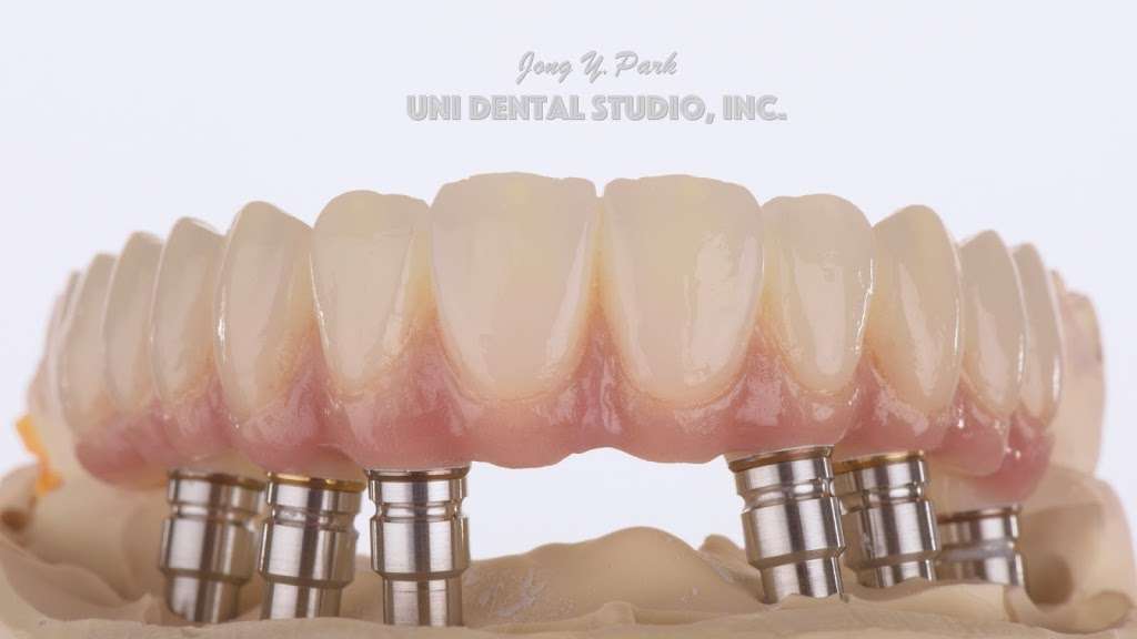 Uni Dental Studio, Inc. | 7120 Minstrel Way STE 105, Columbia, MD 21045, USA | Phone: (410) 381-2928