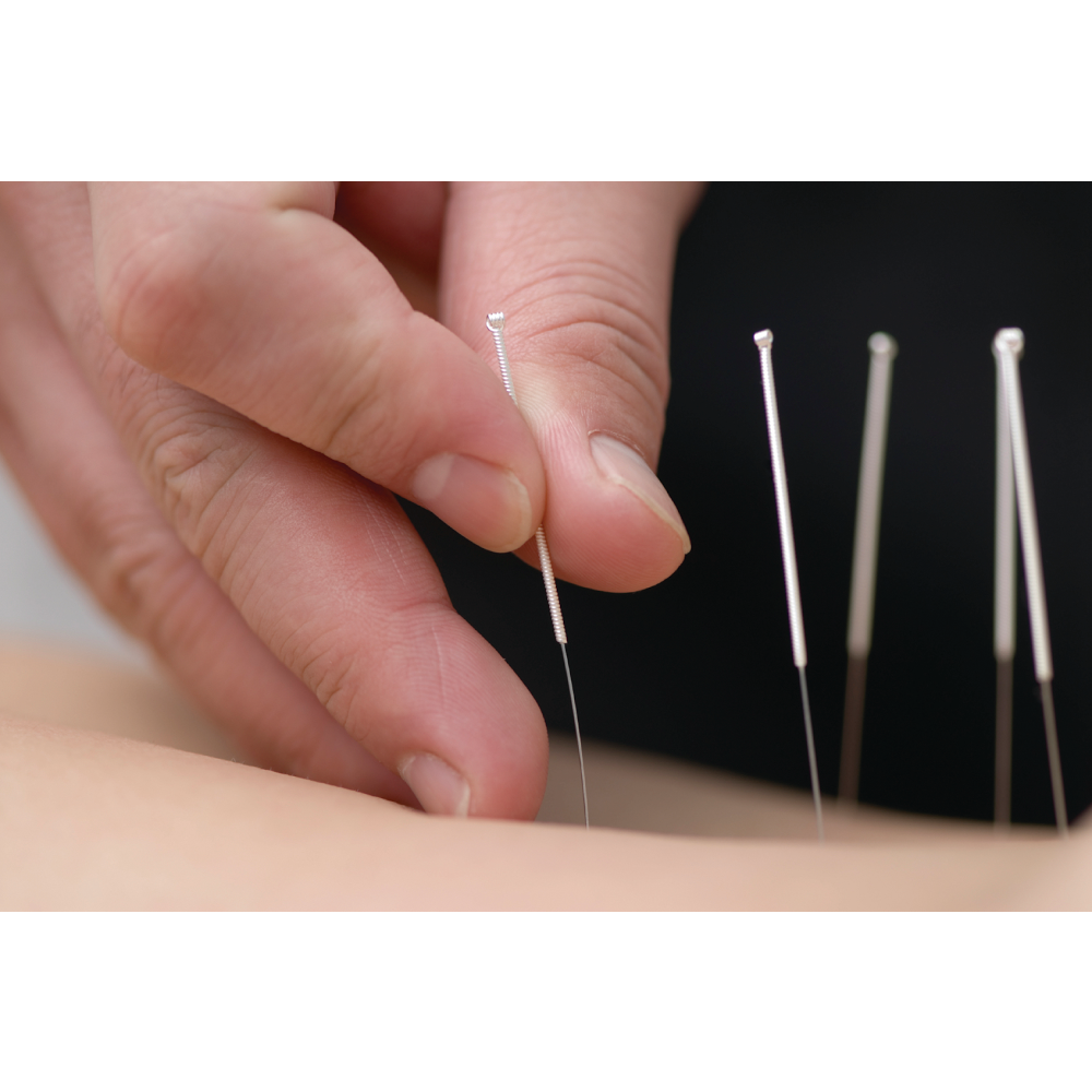 Point of Healing Acupuncture | 114 Water St # 2, Milford, MA 01757 | Phone: (774) 217-0414