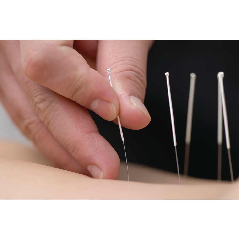 Point of Healing Acupuncture | 114 Water St # 2, Milford, MA 01757, USA | Phone: (774) 217-0414