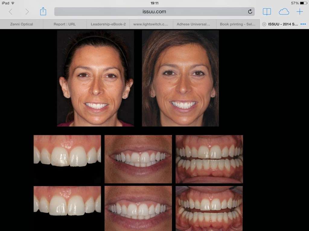 Dental Implants | 4600 Fairmont Pkwy, Pasadena, TX 77504, USA | Phone: (281) 991-1361