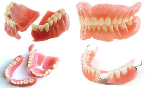 Dental Ceramics | 12 Braydon Rd, London N16 6QB, UK | Phone: 020 8802 9904