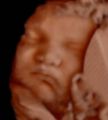 Blooming Baby 3D/4D/HD Ultrasound Studio | 4600 Greenville Ave #185, Dallas, TX 75206, USA | Phone: (214) 696-2229