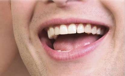 One Stop Implants | 11005 Firestone Blvd, Norwalk, CA 90650, USA | Phone: (562) 863-8888