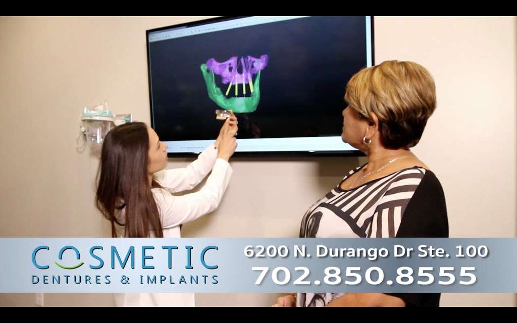 Cosmetic Dentures & Implants | 6200 N Durango Dr Suite 100, Las Vegas, NV 89149, USA | Phone: (702) 850-8555