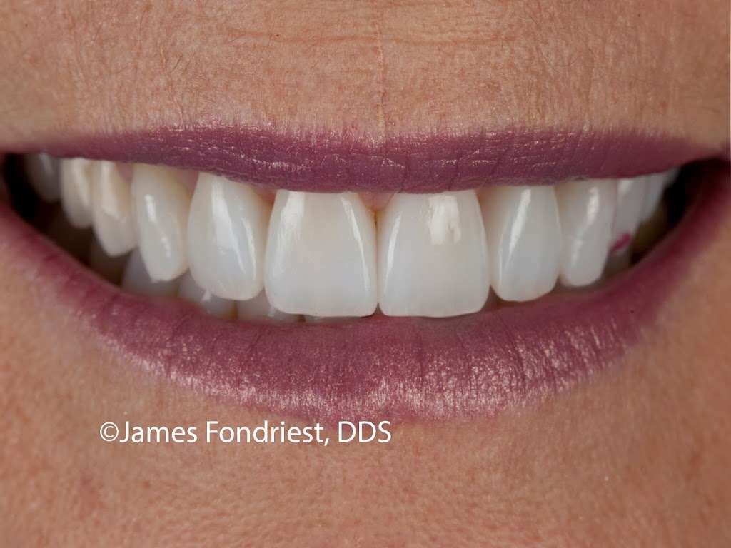 James Fondriest DDS, FACD, FICD | 560 Oakwood Ave #200, Lake Forest, IL 60045, USA | Phone: (847) 234-0517