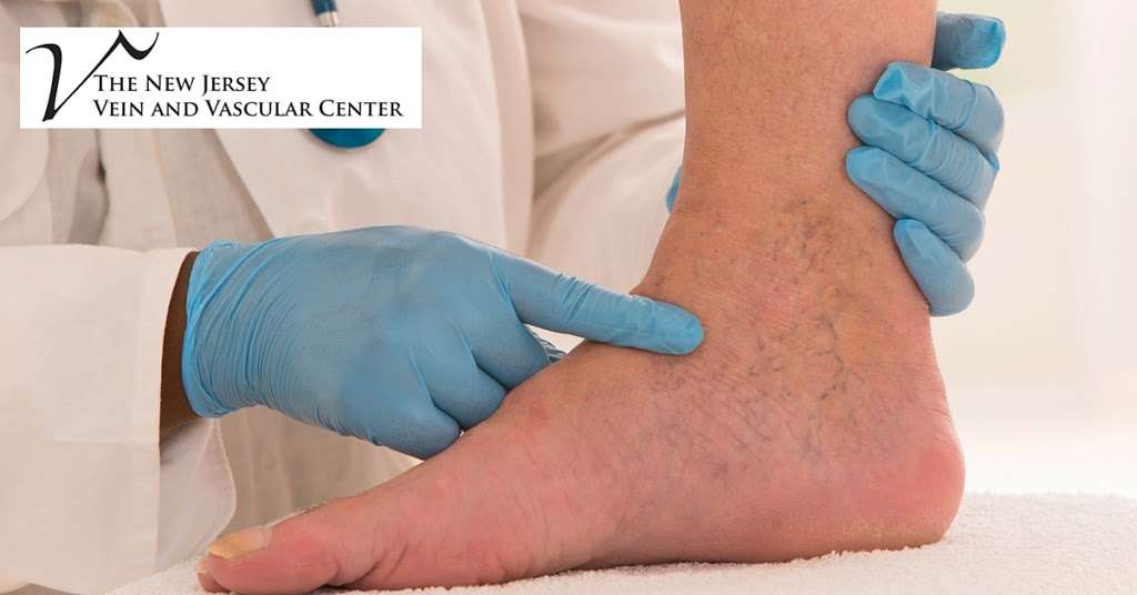 The New Jersey Vein & Vascular Center | 390 Route 10 West, North Building, Randolph, NJ 07869, USA | Phone: (862) 251-7111