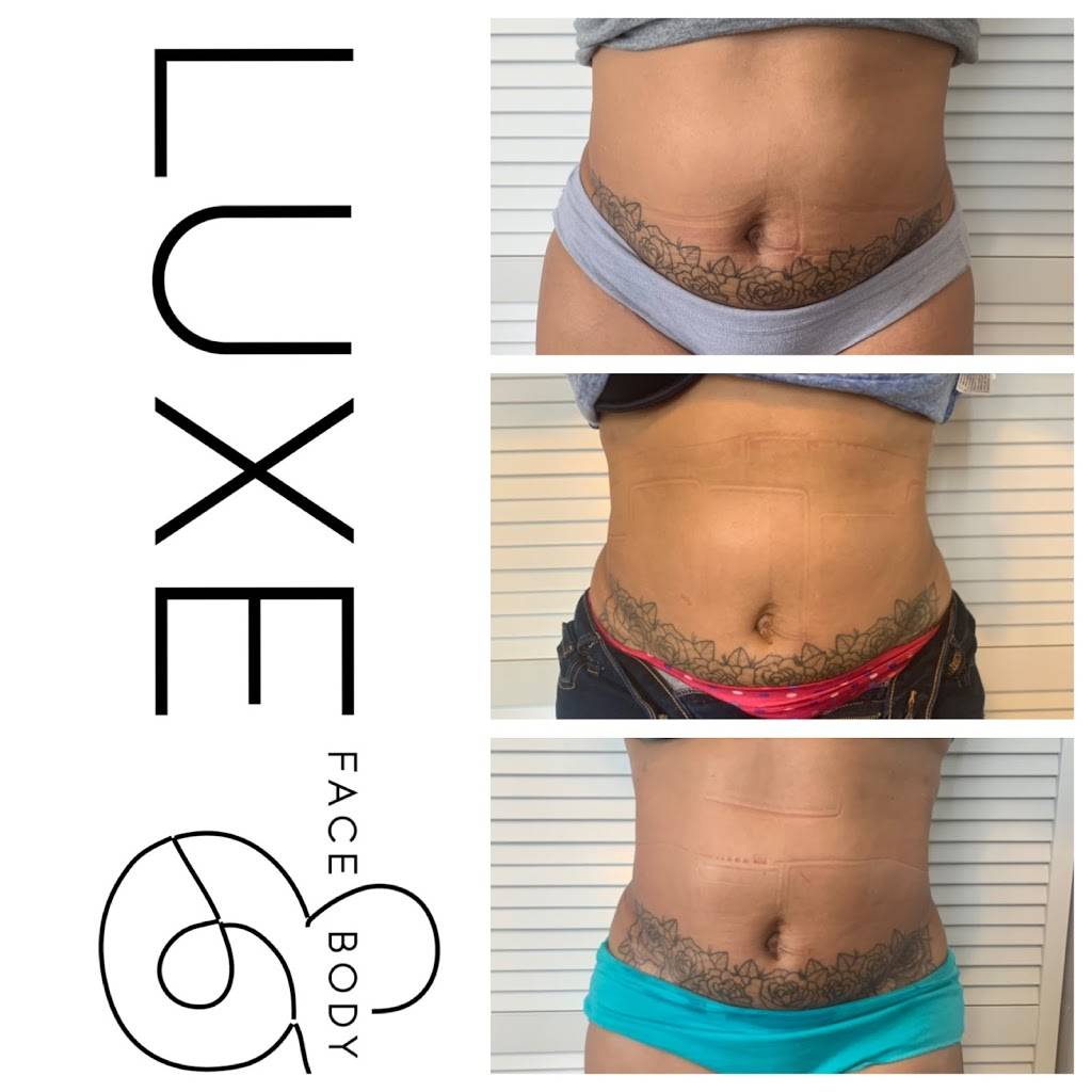 Luxe Face and Body Studio | 1411 W Sligh Ave, Tampa, FL 33604, USA | Phone: (813) 770-9132