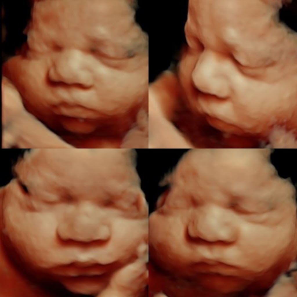 Baby Bump Ultrasound | 7110 E McDonald Dr b6, Scottsdale, AZ 85253, USA | Phone: (480) 219-9066