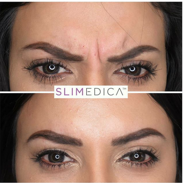 SliMedica | 14615 San Pedro Ave #120, San Antonio, TX 78232, USA | Phone: (210) 971-4000