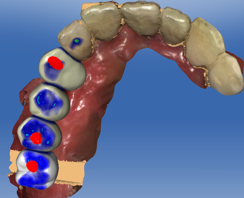 Digital Dental Designs | 3651 E Tremont Ave, Bronx, NY 10465, USA | Phone: (914) 584-9753