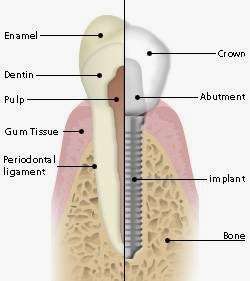 Excel Dental Care | 3980 Glenfeliz Blvd, Los Angeles, CA 90039, USA | Phone: (323) 663-2050